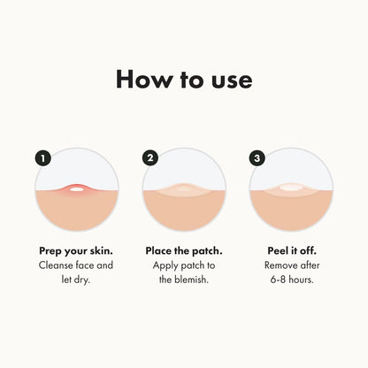 Mighty Patch Original - Hydrocolloid Acne Pimple Patch Spot Treatment (36ct) for.