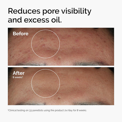 The Ordinary Niacinamide 10% + Zinc 1% - 30 ml, 769915190311